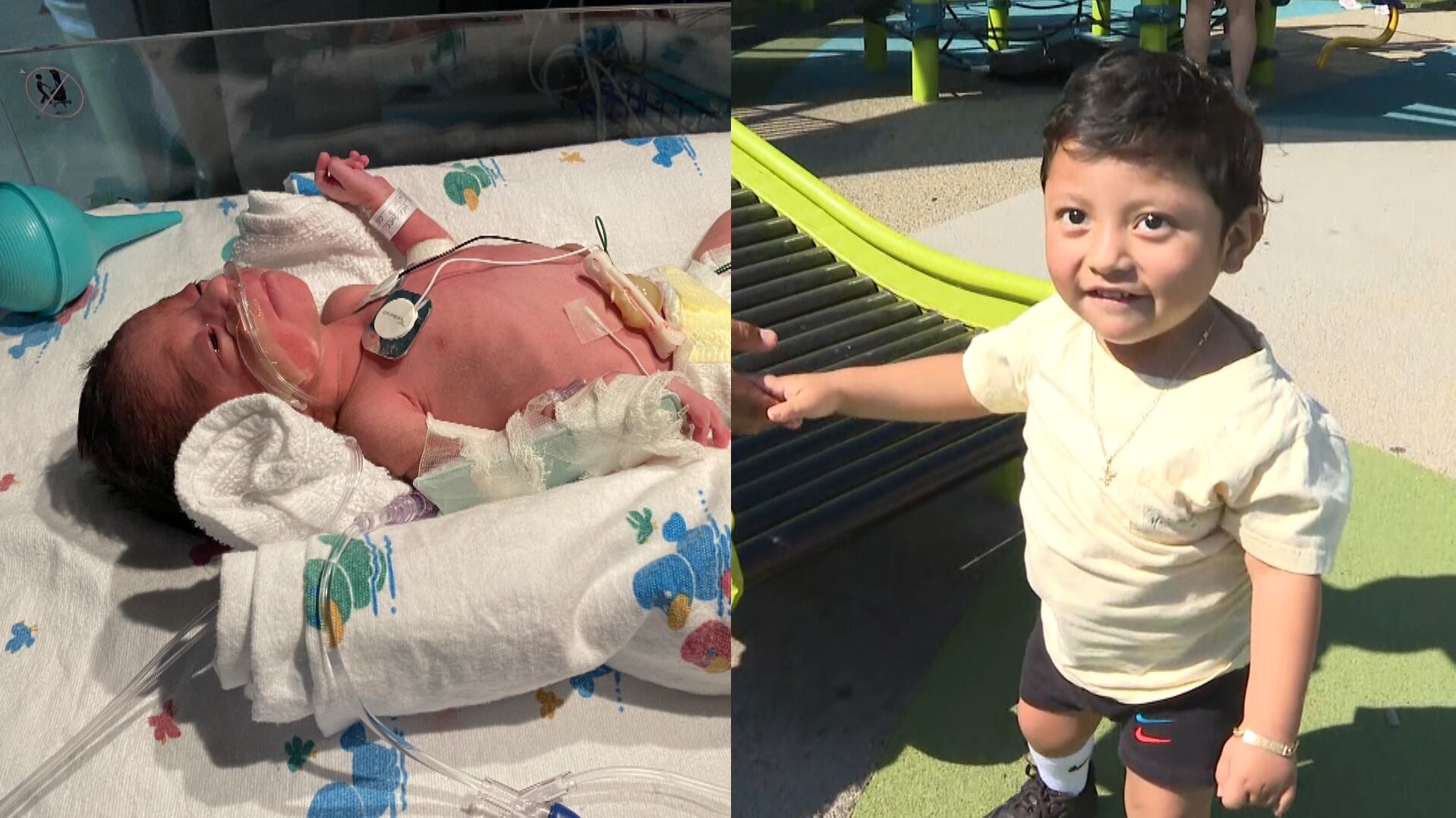 Children's Miracle Network: Meet Leo - Vimarsana News